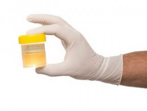 RIA or EMIT-based urine testing