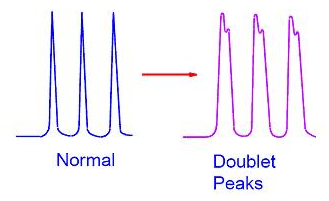 normal peaks versus doublets in a chromatogram
