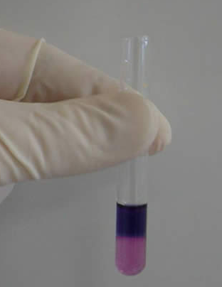 This is the end result of the modified Duquenois-Levine test. This picture is after the HCl and the chloroform are added. There is a deep purple color at the top and then a pink color at the bottom.